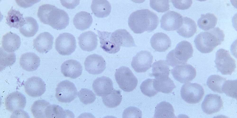 Solanum pennellii Histone H1-Baculovirus