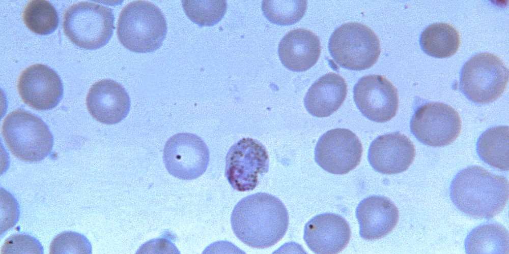 Platynereis dumerilii Histone H1B, sperm-Baculovirus