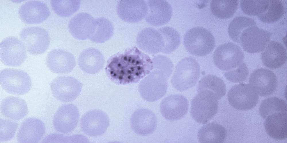 Chironomus tentans Histone H1B-Baculovirus