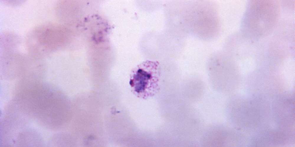 Chironomus pallidivittatus Histone H1E-Baculovirus